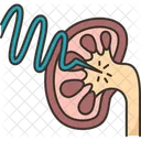 Kidney Shockwave Lithotripsy アイコン
