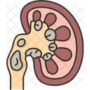 Kidney Stone Diagnosis アイコン