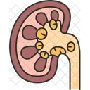 Kidney Stone Disease アイコン