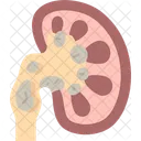Kidney Stone Diagnosis アイコン
