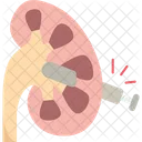 Kidney Tunnel Surgery アイコン