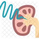 Kidney Shockwave Lithotripsy アイコン