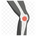 Knieschmerzen Arthritis Gelenkschmerzen Symbol