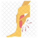Leg Fractured Leg Pain Leg Bleeding Icon