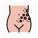 Lichen Shingles Disease Icon