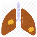 Lungs Disease Lungs Cancer Adenocarcinoma Icon