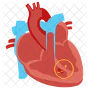 Malformation Cardiaque Congenitale Malformation Cardiaque Coeur Icône