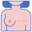 Mastectomy Breast Removal Icon