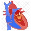 Mitral Stenosis Atherosclerosis Arteriosclerosis Icon