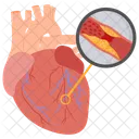 Myocardial Infarction Heart Attack Cardiology Icon