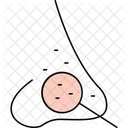 Nose with acne  Icon
