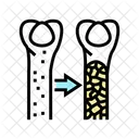 Osteoporosis  Icon