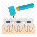 Perforacion Dental Tratamiento Dental Cuidado Dental Icono