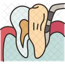 Periodontal Inflammation Gums Icon