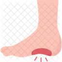 Plantar Fasciitis Foot Icon