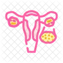 Polycystic Ovary Syndrome Icon