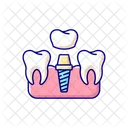 Procedimiento de implantes dentales.  Icono