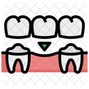 Puente dental  Icono