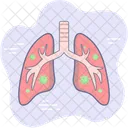 Pneumonia pulmonar  Ícone