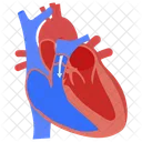 Pulmonary Regurgitation Aortic Stenosis Atrial Defect Icon