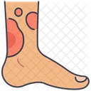 Quemaduras en los pies  Icono