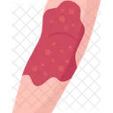 Rashes  アイコン