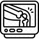 Radiografia Artritis Articulacion De La Rodilla Icono