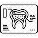 Radiografía  Icono
