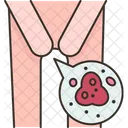 Recurring Yeast Parasites Icon