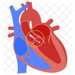 Régurgitation de la valve aortique  Icône