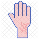 Rissige Haut Finger Hand Symbol