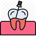 Root Canal Canal Dental Icon