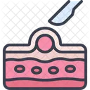 Skin Cyst Removal Scalpel Icon