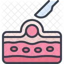 Skin Cyst Removal Scalpel Icon