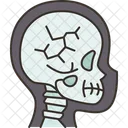 Skull Fracture Injury Icon