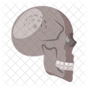 Brain Tumor Skull Base Icon