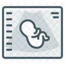 Sonography Report Sonography Ultrasound Icon