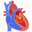 Stenose Mitrale Atherosclerose Arteriosclerose Icône