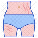 Stretch Mark  Icon