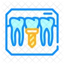 Teeth Implant  Icon