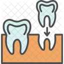 Teeth Implant  Icon