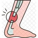 Tendon Rupture Achilles Icon