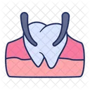 Tooth Extraction Pain Icon