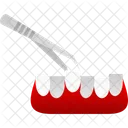 Tooth Extraction Dental Extraction Icon