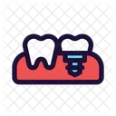 Tooth Treatment Implant Icon