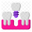 Tooth Implant Implant Tooth Icon