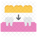 Tooth Implant  Icon