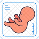 초음파 임신 아기 아이콘