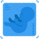 초음파 임신 아기 아이콘
