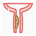 Urethral Stricture Urology Icon